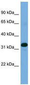 Zinc Finger Protein 511 antibody, TA341465, Origene, Western Blot image 