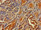 OMA1 Zinc Metallopeptidase antibody, LS-C397343, Lifespan Biosciences, Immunohistochemistry paraffin image 