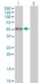 Zinc Finger And BTB Domain Containing 25 antibody, H00007597-M05, Novus Biologicals, Western Blot image 