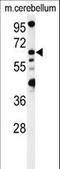 Vacuolar fusion protein MON1 homolog B antibody, LS-C158162, Lifespan Biosciences, Western Blot image 