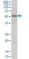 VRK Serine/Threonine Kinase 2 antibody, H00007444-M01, Novus Biologicals, Western Blot image 