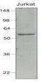 Interferon Regulatory Factor 7 antibody, GTX50051, GeneTex, Western Blot image 