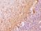 Neurofilament Heavy antibody, M05307, Boster Biological Technology, Immunohistochemistry paraffin image 