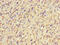 NIM1 Serine/Threonine Protein Kinase antibody, CSB-PA810298LA01HU, Cusabio, Immunohistochemistry frozen image 