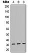 Neutrophil Cytosolic Factor 1 antibody, LS-C356210, Lifespan Biosciences, Western Blot image 