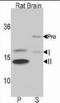 Microtubule Associated Protein 1 Light Chain 3 Beta antibody, TA324625, Origene, Western Blot image 