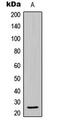 BCL2L2-PABPN1 Readthrough antibody, MBS8237343, MyBioSource, Western Blot image 