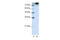 Eukaryotic Translation Initiation Factor 3 Subunit B antibody, 29-316, ProSci, Western Blot image 