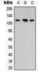 Rho GTPase Activating Protein 30 antibody, LS-C354280, Lifespan Biosciences, Western Blot image 