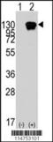 Receptor Tyrosine Kinase Like Orphan Receptor 1 antibody, TA302193, Origene, Western Blot image 