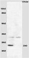 Casein Beta antibody, orb10184, Biorbyt, Western Blot image 