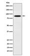 EWS RNA Binding Protein 1 antibody, M00589-2, Boster Biological Technology, Western Blot image 