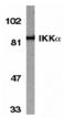 Component Of Inhibitor Of Nuclear Factor Kappa B Kinase Complex antibody, A01918, Boster Biological Technology, Western Blot image 