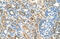 Solute Carrier Family 22 Member 16 antibody, ARP44073_T100, Aviva Systems Biology, Immunohistochemistry frozen image 