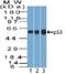 Complement C3b/C4b Receptor 1 (Knops Blood Group) antibody, orb389111, Biorbyt, Western Blot image 
