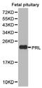 Prolactin antibody, LS-C192877, Lifespan Biosciences, Western Blot image 