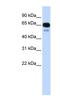 Solute Carrier Family 22 Member 8 antibody, NBP1-60107, Novus Biologicals, Western Blot image 