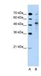 Tripartite Motif Containing 59 antibody, NBP1-59777, Novus Biologicals, Western Blot image 