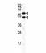 Carbonic Anhydrase 9 antibody, F48971-0.4ML, NSJ Bioreagents, Western Blot image 