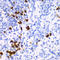 Transcription Factor A, Mitochondrial antibody, A01119, Boster Biological Technology, Immunohistochemistry paraffin image 