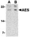 TLE Family Member 5, Transcriptional Modulator antibody, orb74656, Biorbyt, Western Blot image 