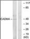 CADM4 antibody, orb96042, Biorbyt, Western Blot image 