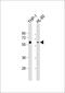 HCK Proto-Oncogene, Src Family Tyrosine Kinase antibody, M01073, Boster Biological Technology, Western Blot image 