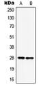 Homeobox B9 antibody, MBS822057, MyBioSource, Western Blot image 