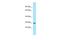 Signal Transducing Adaptor Family Member 1 antibody, A09142, Boster Biological Technology, Western Blot image 