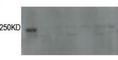 Leucine Rich Repeat Kinase 2 antibody, abx033174, Abbexa, Western Blot image 