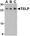 Thymic Stromal Lymphopoietin antibody, AP22662PU-N, Origene, Western Blot image 