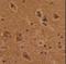 CTD Phosphatase Subunit 1 antibody, LS-C167121, Lifespan Biosciences, Immunohistochemistry paraffin image 