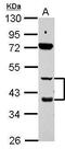 Retinoic Acid Receptor Beta antibody, GTX100759, GeneTex, Western Blot image 