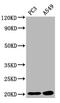 Sorting Nexin 12 antibody, CSB-PA891787LA01HU, Cusabio, Western Blot image 