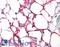 Fms Related Tyrosine Kinase 3 antibody, LS-B4049, Lifespan Biosciences, Immunohistochemistry frozen image 