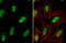 ELAV Like RNA Binding Protein 1 antibody, GTX134821, GeneTex, Immunocytochemistry image 