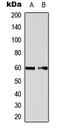 Eukaryotic Translation Initiation Factor 2B Subunit Delta antibody, LS-C358968, Lifespan Biosciences, Western Blot image 