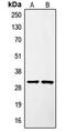 SURF1 Cytochrome C Oxidase Assembly Factor antibody, MBS820187, MyBioSource, Western Blot image 