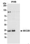 SEC22 Homolog B, Vesicle Trafficking Protein (Gene/Pseudogene) antibody, NBP2-37701, Novus Biologicals, Immunoprecipitation image 