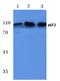 Eukaryotic Translation Elongation Factor 2 antibody, A00830, Boster Biological Technology, Western Blot image 