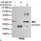 General Transcription Factor IIH Subunit 1 antibody, LS-C812983, Lifespan Biosciences, Immunoprecipitation image 
