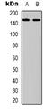 Laminin Subunit Gamma 2 antibody, abx133764, Abbexa, Western Blot image 