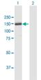 Thrombospondin 4 antibody, H00007060-B01P, Novus Biologicals, Western Blot image 