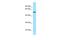 Src-Related Kinase Lacking C-Terminal Regulatory Tyrosine And N-Terminal Myristylation Sites antibody, A06352, Boster Biological Technology, Western Blot image 