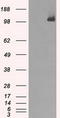 BUB1 Mitotic Checkpoint Serine/Threonine Kinase B antibody, TA500607S, Origene, Western Blot image 