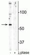 Syntaxin Binding Protein 1 antibody, P02351, Boster Biological Technology, Western Blot image 