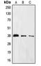 Eukaryotic Translation Initiation Factor 2 Subunit Alpha antibody, MBS821692, MyBioSource, Western Blot image 