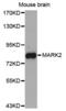 Microtubule Affinity Regulating Kinase 2 antibody, abx004536, Abbexa, Western Blot image 
