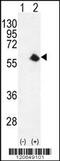 Cyclin Dependent Kinase 8 antibody, 56-151, ProSci, Western Blot image 