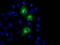 Protein Kinase, Membrane Associated Tyrosine/Threonine 1 antibody, MA5-25034, Invitrogen Antibodies, Immunocytochemistry image 